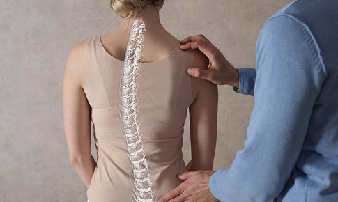 Thuốc điều trị vẹo cột sống