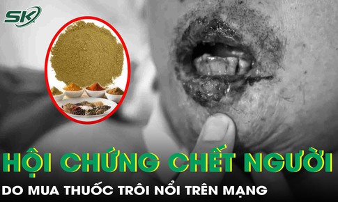 Mua thuốc trôi nổi trên mạng, người đàn ông mắc hội chứng chết người, tiên lượng tử vong cao