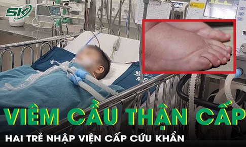 Ph&#249; mặt, sưng ch&#226;n kh&#244;ng r&#245; nguy&#234;n nh&#226;n, hai trẻ nhập viện khẩn vi&#234;m cầu thận cấp
