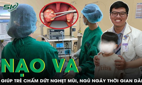 Phẫu thuật nạo VA giúp trẻ chấm dứt nghẹt mũi, ngủ ngáy suốt thời gian dài