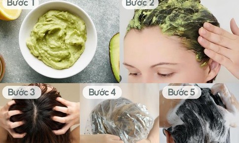 6 thói quen giúp hạn chế tóc khô xơ, gãy rụng