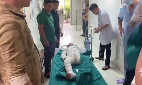 Dùng xăng để đốt kiến, hai anh em bỏng nặng