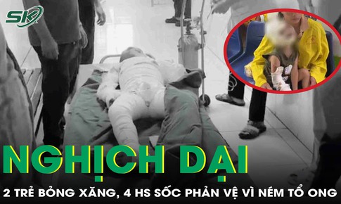 Cảnh báo tai nạn từ trò nghịch dại: 2 trẻ bỏng nặng do xăng, 4 học sinh sốc phản vệ vì ném tổ ong