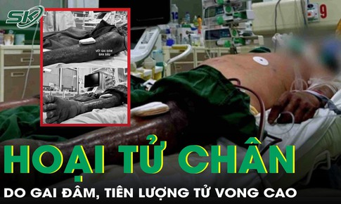 Lội xuống đầm tôm, người đàn ông hoại tử chân vì bị gai đâm, tiên lượng tử vong cao