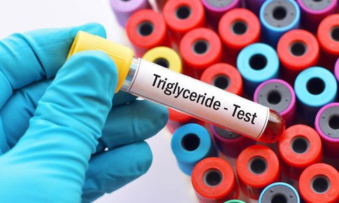 Chỉ số triglyceride cao có nguy hiểm không?