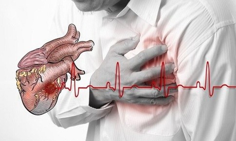 Các yếu tố nguy cơ gây nhồi máu cơ tim