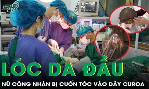 Xót xa: Nữ công nhân bị lóc da đầu vì tóc cuốn vào dây curoa