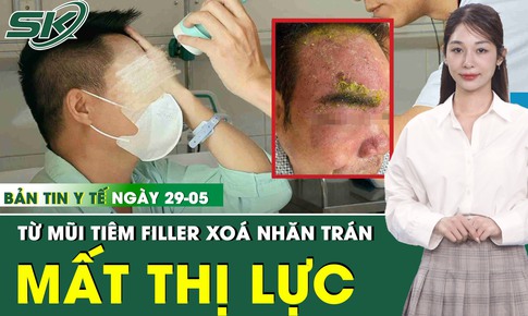 Bản tin Y tế 29/5: Tiêm filler trẻ hoá, người đàn ông 45 tuổi bất ngờ đau buốt, mất thị lực