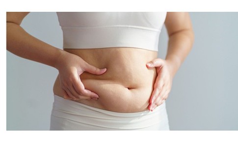 Có thể loại bỏ mỡ bụng mà không cần tập luyện?