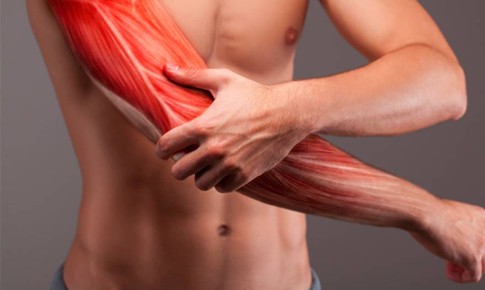 Viêm cơ, áp xe cơ: Nguyên nhân, triệu chứng, cách điều trị và phòng ngừa