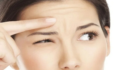 Nếp nhăn trán khi còn trẻ, làm sao để mờ dần?