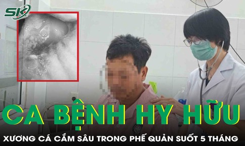 Ca bệnh hy hữu: Mảnh xương sắc nhọn cắm s&#226;u trong phế quản suốt 5 th&#225;ng 