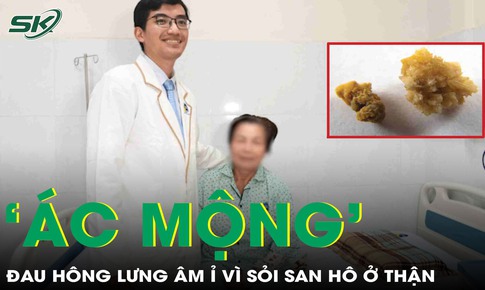 Giải thoát người phụ nữ khỏi 'ác mộng' đau hông lưng âm ỉ vì sỏi san hô ở thận