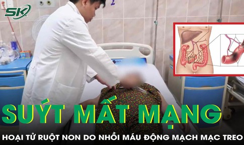 Suýt mất mạng vì hoại tử ruột non do nhồi máu động mạch mạc treo