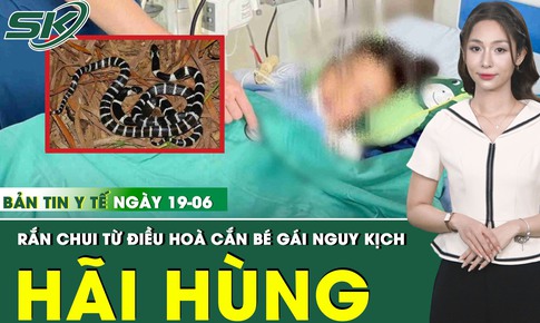 Bản tin Y tế 19/6: Rắn cạp nia chui ra từ điều h&#242;a, cắn b&#233; g&#225;i 7 tuổi nguy kịch