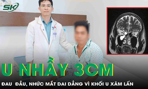Phẫu thuật cắt u nhầy xoang hàm kích thước lớn xâm lấn sàn sọ hủy xương ổ mắt