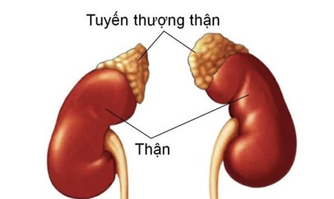 Suy tuyến thượng thận do lạm dụng thuốc điều trị bệnh gout