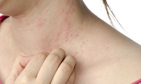 6 dấu hiệu cảnh báo gan bị nhiễm độc bạn đã biết chưa?