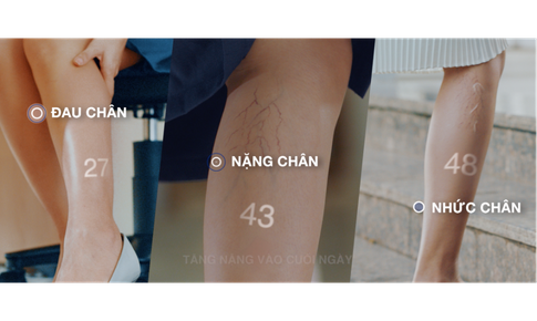 Điều trị hiệu quả triệu chứng suy giãn tĩnh mạch từ chiết xuất vỏ cam non