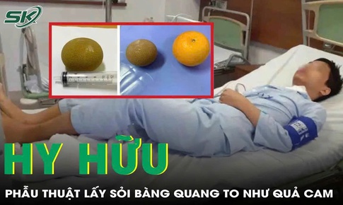 Phẫu thuật lấy sỏi b&#224;ng quang to như quả cam cho bệnh nh&#226;n 69 tuổi