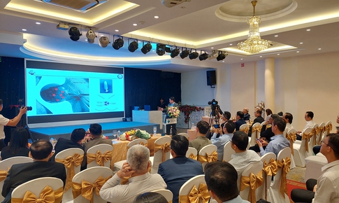 Laser có điều trị khỏi bệnh trĩ?