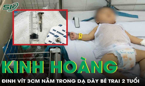 Kinh hoàng: Phẫu thuật lấy đinh vít dài 3cm trong dạ dày bé trai 29 tháng tuổi