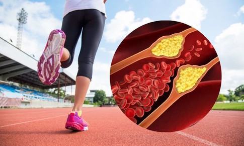 Cần đi bộ bao nhi&#234;u để hạ cholesterol?