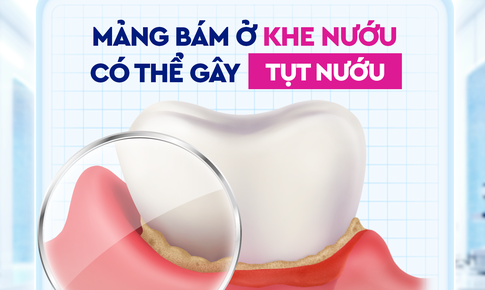 Đánh răng sau khi ăn: Liệu có cần thiết?