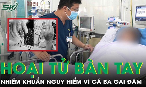 Hoại tử bàn tay vì cá ba gai đâm, cảnh báo vi khuẩn nguy hiểm