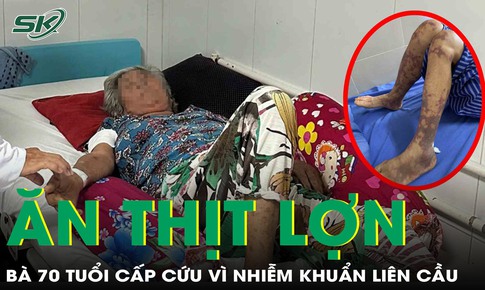 Cấp cứu vì nhiễm khuẩn nguy hiểm sau bữa cơm thịt lợn