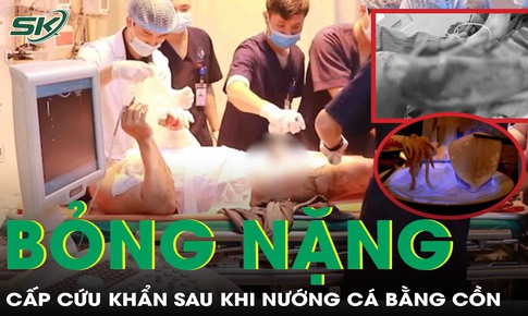 Cấp cứu bỏng độ 2, tổn thương toàn bộ cánh tay vì nướng cá bằng cồn