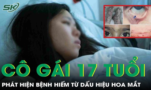 Tưởng hoa mắt do thiếu máu, cô gái 17 tuổi bàng hoàng phát hiện mắc hội chứng Evans hiếm gặp