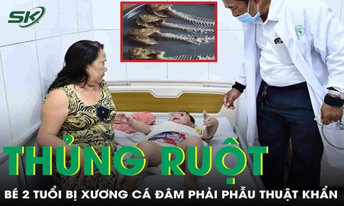 Bé trai 2 tuổi bị xương cá đâm thủng ruột phải phẫu thuật khẩn