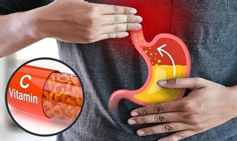 8 nhóm người không nên bổ sung vitamin C liều cao