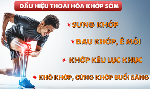 Tiếp cận sớm trong xử l&#253; tho&#225;i h&#243;a khớp sớm - Liệu ph&#225;p miễn dịch dung nạp đường uống với collagen Collavant&#174; n2