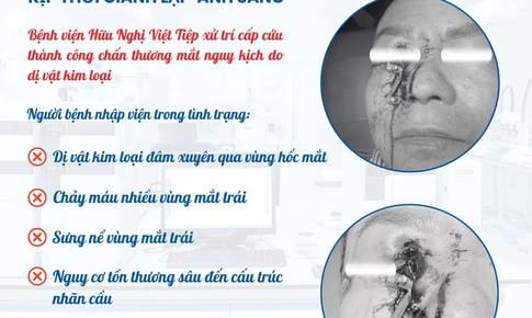 Hải Phòng: Xử trí thành công ca chấn thương mắt nguy kịch do dị vật kim loại
