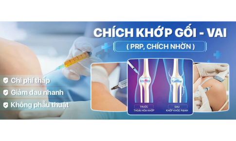 Tiêm huyết tương giàu tiểu cầu - Giải pháp cho người thoái hóa khớp gối?