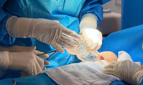 Ám ảnh nâng ngực đau, không dám tháo túi ngực