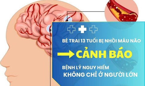 Bé trai 13 tuổi bị nhồi máu não: Cảnh báo bệnh lý nguy hiểm không chỉ ở người lớn