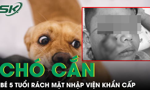 Bé 5 tuổi bị chó cắn rách mặt, cảnh báo liên tiếp nhiều trẻ cấp cứu vì động vật tấn công
