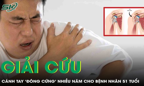 Giải cứu c&#225;nh tay &#39;đ&#244;ng cứng&#39; suốt nhiều năm cho bệnh nh&#226;n 51 tuổi