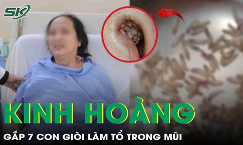 Ổ gi&#242;i l&#224;m tổ c&#249;ng dị vật sỏi trong hốc mũi khiến người phụ nữ nghẹt mũi, chảy m&#225;u li&#234;n tục