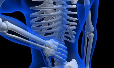 Viêm cột sống dính khớp có nguy hiểm không, những ai dễ mắc bệnh?