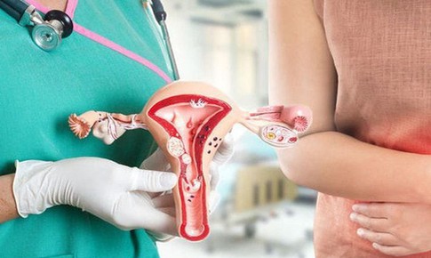 Polyp cổ tử cung c&#243; nguy hiểm kh&#244;ng?