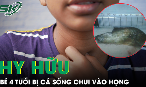 Cứu b&#233; trai 4 tuổi bị c&#225; r&#244; đồng sống chui v&#224;o họng khi đang chơi với c&#225;