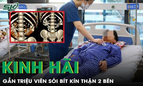 Suýt chạy thận cả đời vì chủ quan khiến hai bên thận ken đặc cả triệu viên sỏi