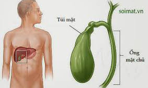 Ung thư túi mật có chữa khỏi không?