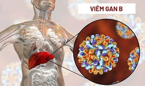 Biểu hiện của viêm gan B giai đoạn đầu
