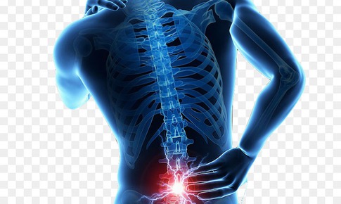 Thoát vị đĩa đệm điều trị thế nào?