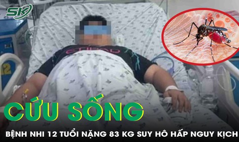 Cứu sống bệnh nhi 12 tuổi béo phì sốc sốt xuất huyết, biến chứng suy hô hấp nặng